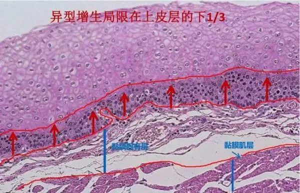 胃痛别不当回事，顾卫能可以调理胃病