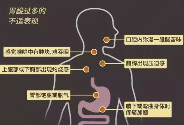 顾卫能柠檬味固体饮料