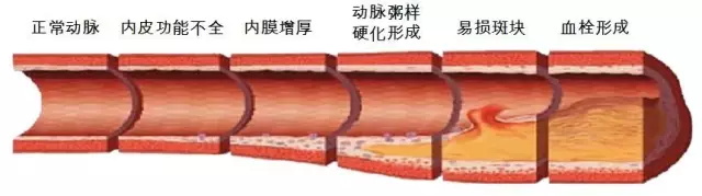 美乐家护欣宜纳豆压片糖果