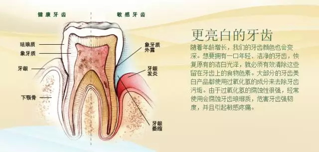 洁齿牙膏—鲜薄荷醇肉桂