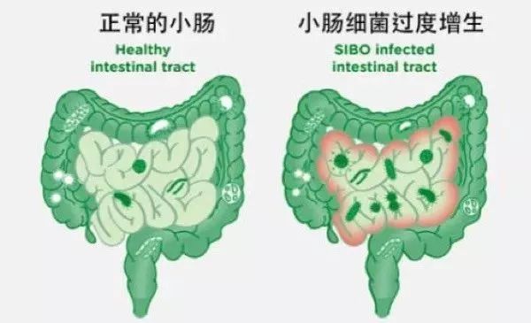 美乐家牛至精油