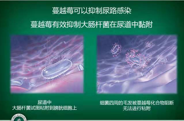 蔓越莓可以增强免疫力、预防女性泌尿系统感染