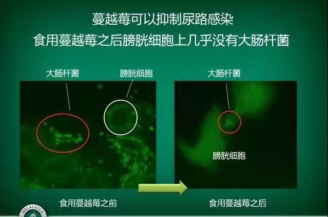 蔓越莓可以增强免疫力、预防女性泌尿系统感染