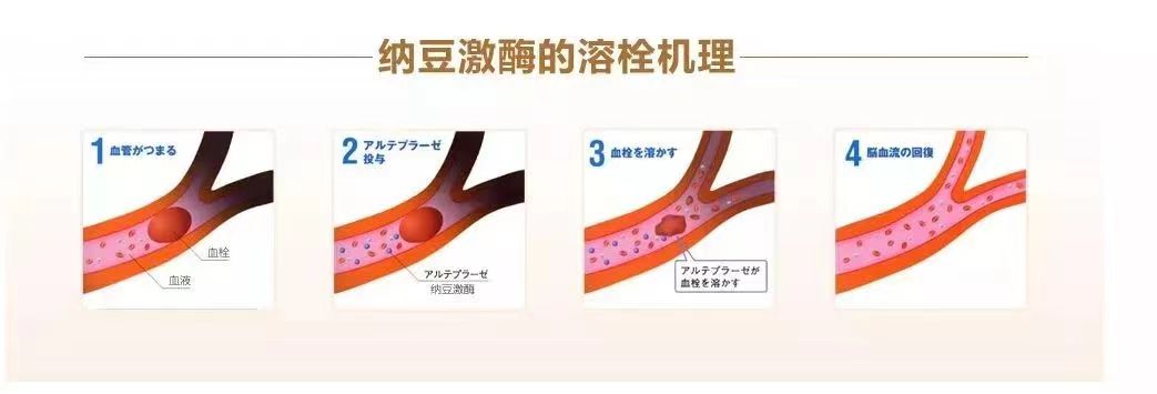 预防血栓，最好的是纳豆激酶，而非阿司匹林