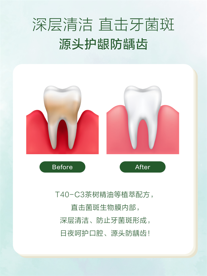 为什么推荐美乐家牙膏