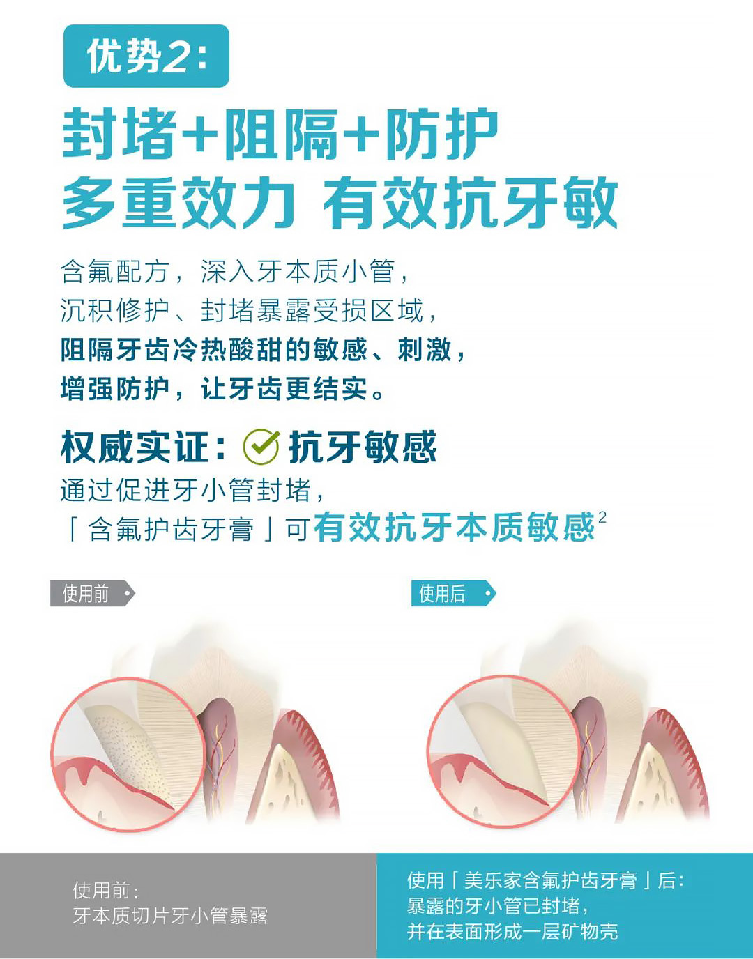 美乐家含氟牙膏